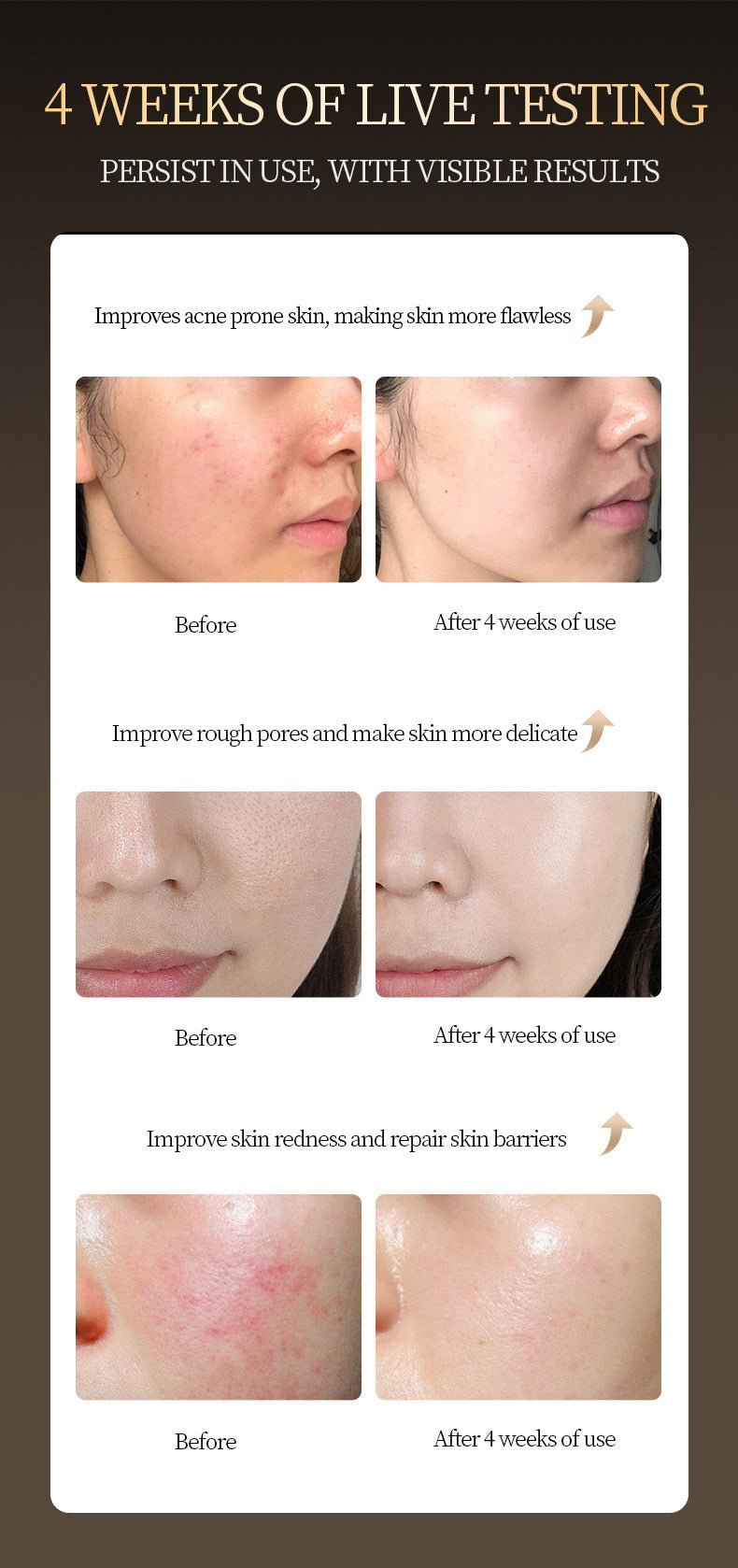 2Bmagic at-home face mask device side view